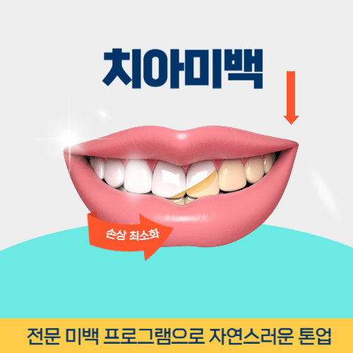 광명치과 광명시 치과 치아미백