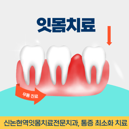 광명치과 광명시 치과 잇몸치료